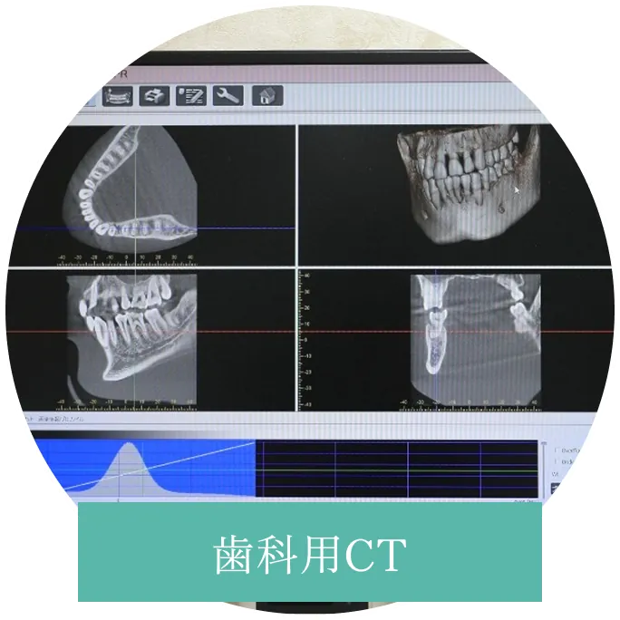 歯科用CT
