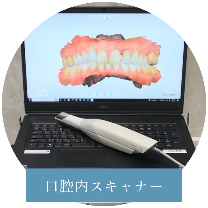 口腔内スキャナー