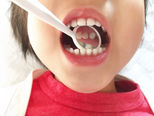 顎の自然な成長を促す子どものためのマウスピース矯正